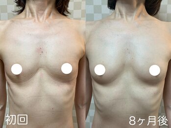 ハレオラ(HaleOla)/50代☆ハリも弾力もUP！