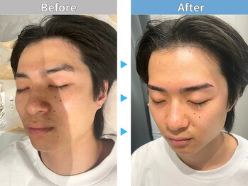 マユクリア 錦糸町店/美眉B/A【眉毛/眉毛サロン】