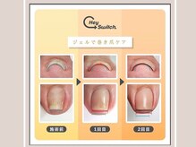 ニフ(Nif)の雰囲気(健康は足元から◎ジェルで巻き爪ケアができるヘイスイッチ導入店)