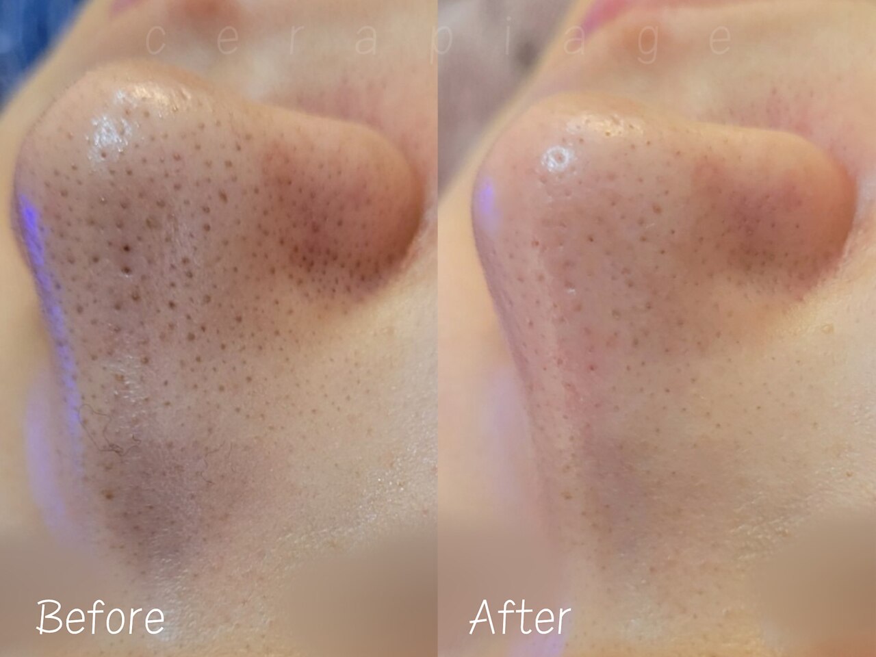 セラピエージ｜ホットペッパービューティー