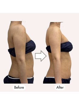 じぶんdeエステ 池袋店/巻き肩改善!!上半身スッキリ