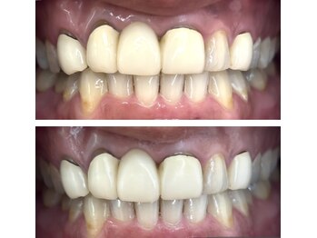 ホワイトニング美白ラボ 筑西店(ホワイトニング美白LAB)/