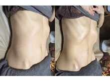 ステラリリィ(Stella Lily)の雰囲気（今注目の腸活で、腸もみのコースが大人気♪）