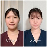 ハンドフィット(Handfit)