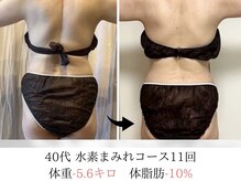 ヨサパーク タキ 上野毛(YOSA PARK TAKI)/40代：水素まみれコース11回