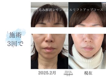 ディアスマイル(Dear.smile)/施術3回で