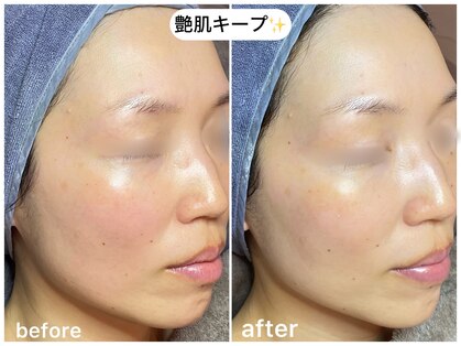 フラックス(flux(旧:京都エンビロンサロンFLUX))の写真