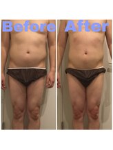 トータルビューティサロン エクスト(EXT)/メンズ★ラフォス100分コース