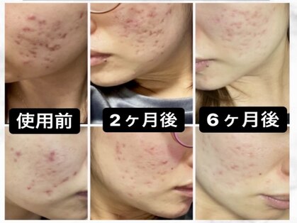 ナチュラーレ 京都四条烏丸店(Naturale)の写真