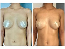 モア(moa)/症例写真