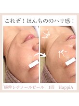 ハピア(HappiA)/純粋レチノールピール