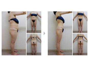 Nビューティー/最新エンダモロジーBODY