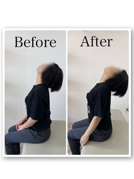 まこと整体院 新鳥栖店/ビフォーアフター（首、肩こり）