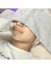 【キッズ脱毛】眉間・鼻下