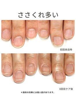 50代/乾燥多/3ヶ月後アフター