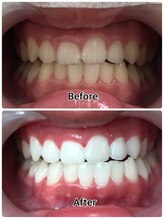 ドクターモック(Dr.MOC)/ＢＥＦＯＲＥ→ＡＦＴＥＲ