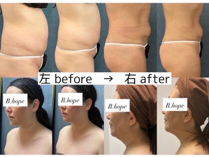 ビーホープ(B.hope)の写真