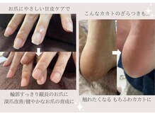 ビビィ(vivie)の雰囲気（お爪周りのゴチゴチ、足裏のカサつきなど、気軽にご利用ください）