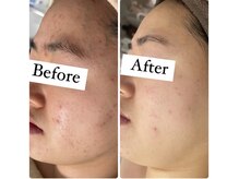 エルア 尼崎(Elua)/