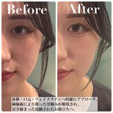 ナノフェイス 名古屋駅前店(nano face)