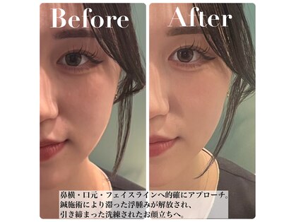 ナノフェイス 名古屋駅前店(nano face)の写真