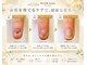 プラウネイル(Plow Nail)の写真