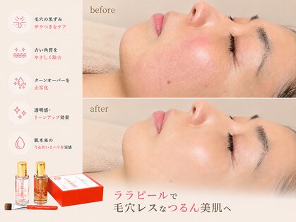 アネラ(ANELA)の写真