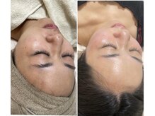 モンクラッシー(Mon classy)/