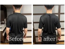 トトノウ 自由が丘店(totonou)/Before after (21)