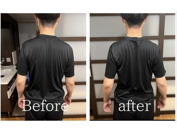 トトノウ 自由が丘店(totonou)/Before after (21)