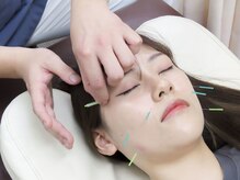 はっちの整骨院の雰囲気（鍼施術で小顔矯正！※美容鍼・美容鍼灸）