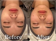 R-1ビューティーサロン 表参道/Before＆After