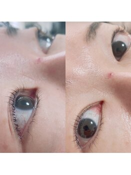 ネマウム(nemaum)/