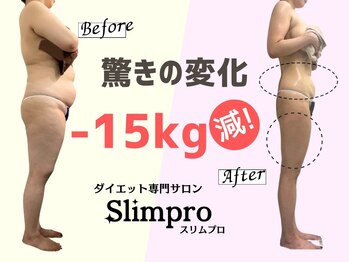 スリムプロ 天王寺店(Slimpro)