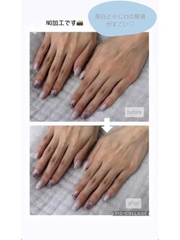 シーオングル(Siii ongle)/フットをしながらハンドマスク