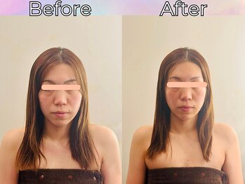 リストアハート(Restore Heart)/血流が良くなりトーンアップも◎