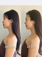 スワフルール(soi Fleur)/女優kogao矯正