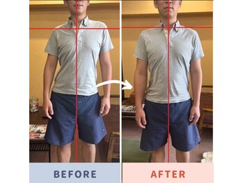 くすの木 治療院/ギックリ、一歩手前！