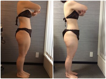 美容整体 ウェリナ 蟹江院/小顔矯正/骨盤矯正/美脚サロン