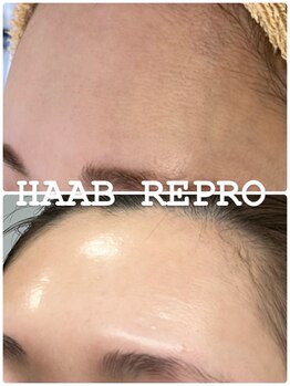 リツイート(ReTweet)/ハーブピーリング・艶・くすみ