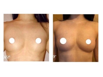 スマイルクルー(SmileClue)/ビフォーアフター症例