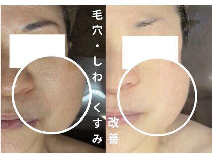 ハル(Halu)の写真