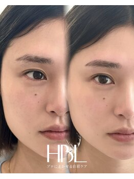 プール 鹿児島中央駅店(POOL)の写真/HBL＆ワックスで顔立ちまで整う♪骨格に合わせた「美眉WAX」と｢HBL」劇的な垢抜け体験＊