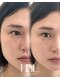プール 鹿児島中央駅店(POOL)の写真/HBL＆ワックスで顔立ちまで整う♪骨格に合わせた「美眉WAX」と｢HBL」劇的な垢抜け体験＊