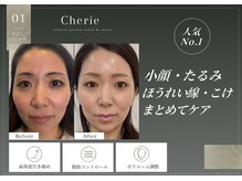 シェリー(Cherie)の雰囲気（たるみ改善切らない脂肪燃焼【小顔/ニキビ/インセルダム/広島】）