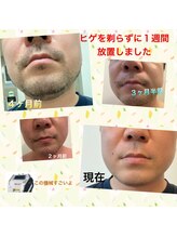 ブロッサム(BLOSSOM)/オーナーのヒゲ