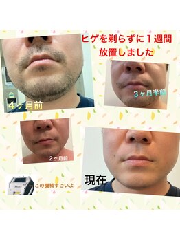 ブロッサム(BLOSSOM)/オーナーのヒゲ