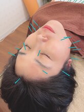 ヒーリングサロン アージュ(A-je)/★美顔鍼＋小顔矯正★