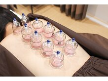 いな穂整体院/カッピング（吸玉）