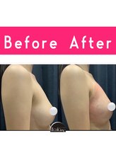 エルフラージュ 銀座店/プルンと美バスト